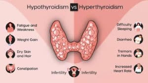 Hypothyroidism vs Hyperthyroidism